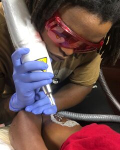 Laser Tattoo removal in Nairobi, Kenya